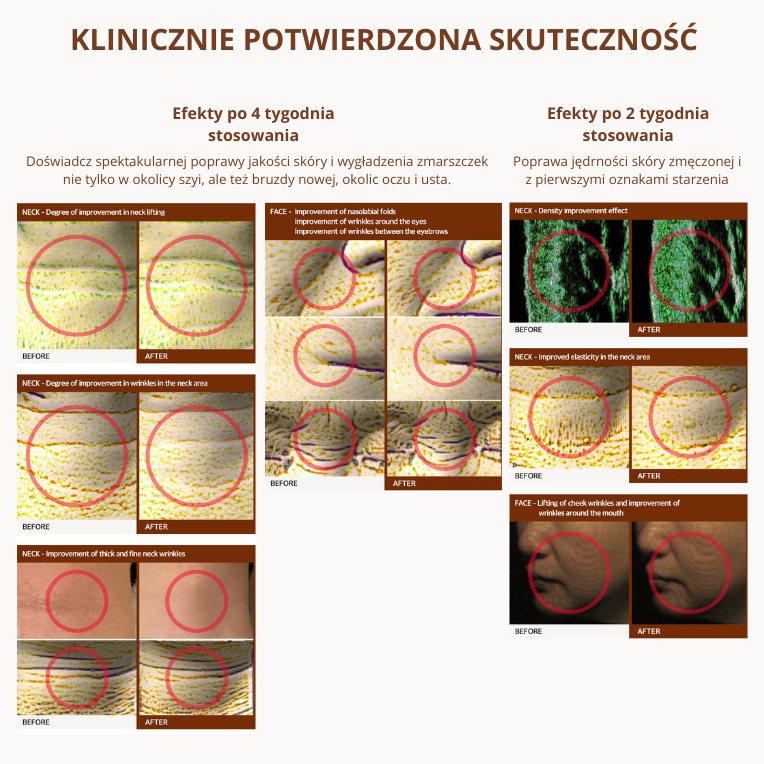 VELLA Vella Neck Cream Ultimate Age Killer | Przeciwstarzeniowy krem do szyi i dekoltu z peptydami, jadem pszczelim i luksusową recepturą anti-aging | 50ml vella_neck_cream_klinicznie_potwierdzona_skutecznosc